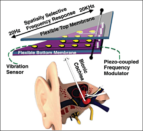 Fig. 10: A bionic ear