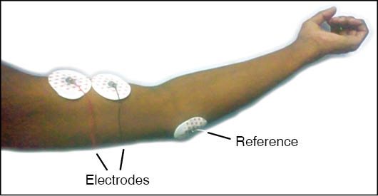 Fig. 2: Electrode placement
