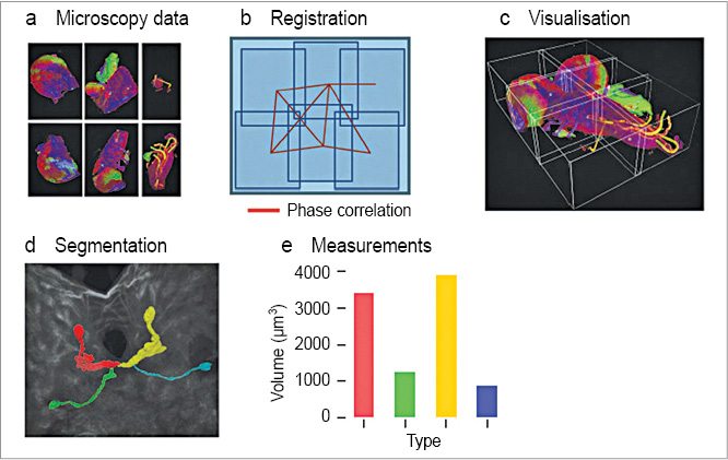 Fig. 2: Some of the main techniques used in the software (a) Stitching plugins helps in gathering different views of the microscopic data, (b) Image registration, (c) Visualisation, (d) Image segmentation and (e) Measurements (Image courtesy: Article titled ‘Fiji: An open source platform for biological-image analysis’ by Johannes Schindelin et al)