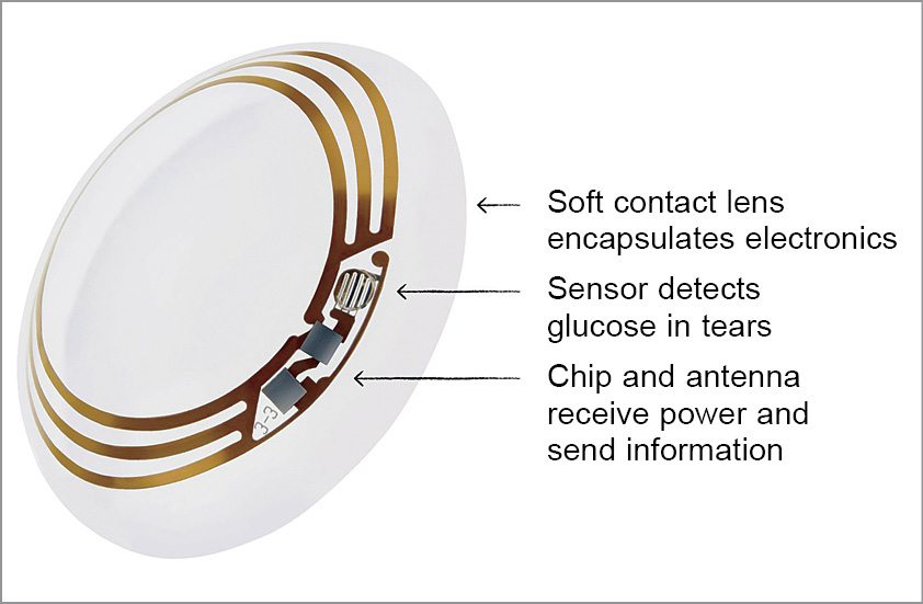 Google’s smart contact lenses