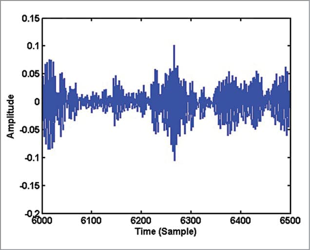 Understanding Spectrogram of Speech Signal Using MATLAB