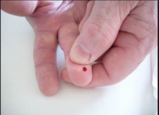 Traces of cancer and other diseases to be found through blood testing using sound waves.