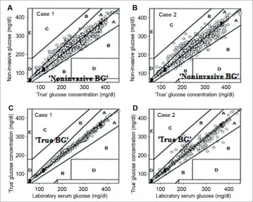 Plot of correlations between true serum glucose invasive concentrations and non-invasive glucose concentrations for cases A and B, and corresponding plots of correlations between invasive (laboratory) serum glucose concentrations and true serum glucose concentrations for cases C and D