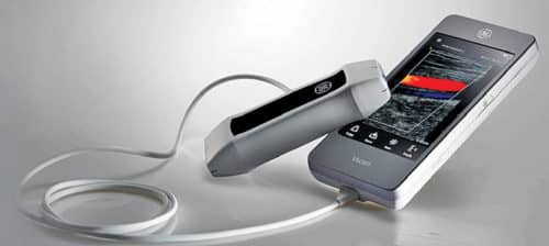 Fig. 1: Vscan portable ultrasound device