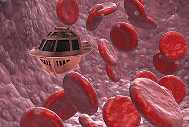 A scene from the 1966 sci-fi movie Fantastic Voyage, which popularised micro-bots (Credit: https://tvtropes.org)