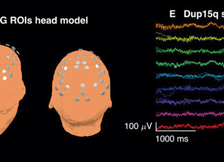 Putting Electronics Of Brain Waves To Use