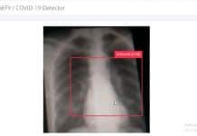 X-Ray-Based Quick COVID-19 Detection With Raspberry Pi