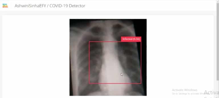 X-Ray-Based Quick COVID-19 Detection With Raspberry Pi