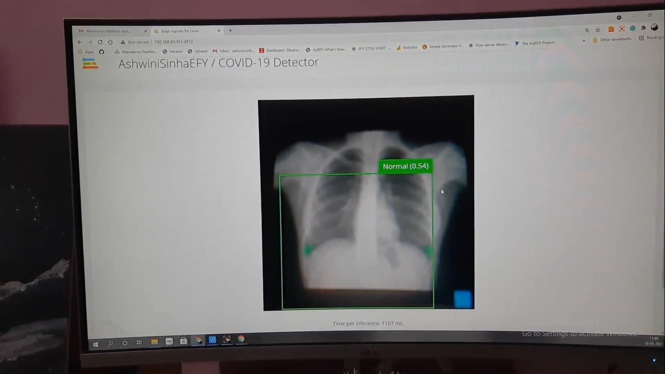 Corona virus infection detection using x-ray