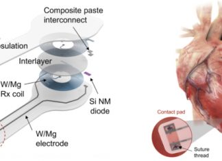 Temporary Cardiac Pacemaker that Dissolves After Operation