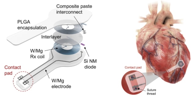 Temporary Cardiac Pacemaker that Dissolves After Operation