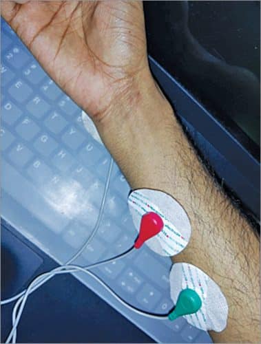 Electrodes connection for EMG