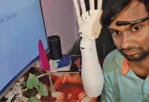 Mind Controlled Prosthetic Arm