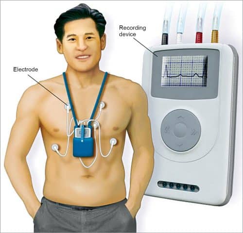 Heart holter, a wearable device that keeps track of heart rhythm (Source: www.mayoclinic.org)