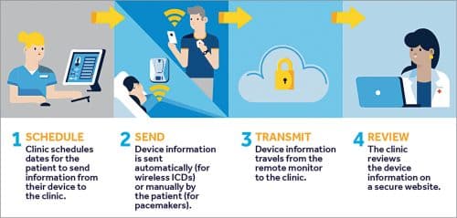 Remote monitoring steps (Source: www.medtronic.com)