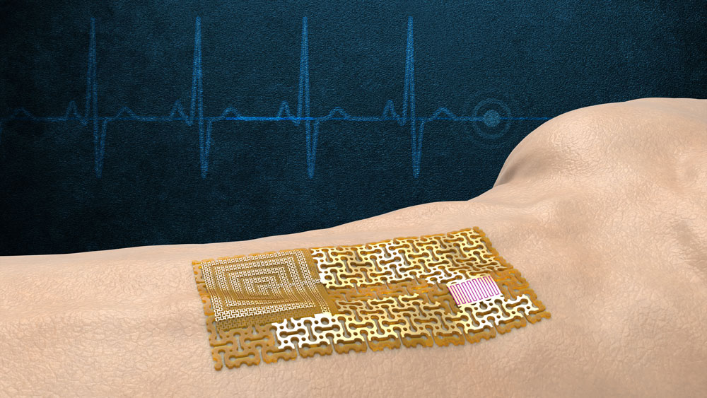 MIT Researchers Design Wireless Electronic ‘Skin’