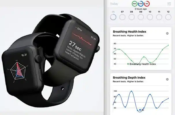 Wearables are Convenient Alternative to ECGs