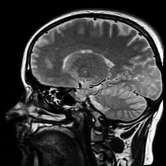 AI-Based Dynamic Brain Imaging