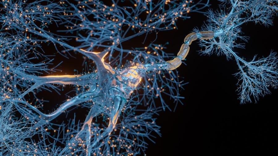 Machine Learning Algorithm That Identifies Progressive Neuro-Degenerative Diseases