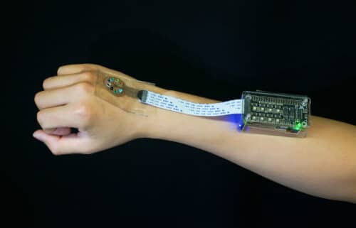 Lupus Diagnosis With 3D-printed Light-Sensitive Medical Device