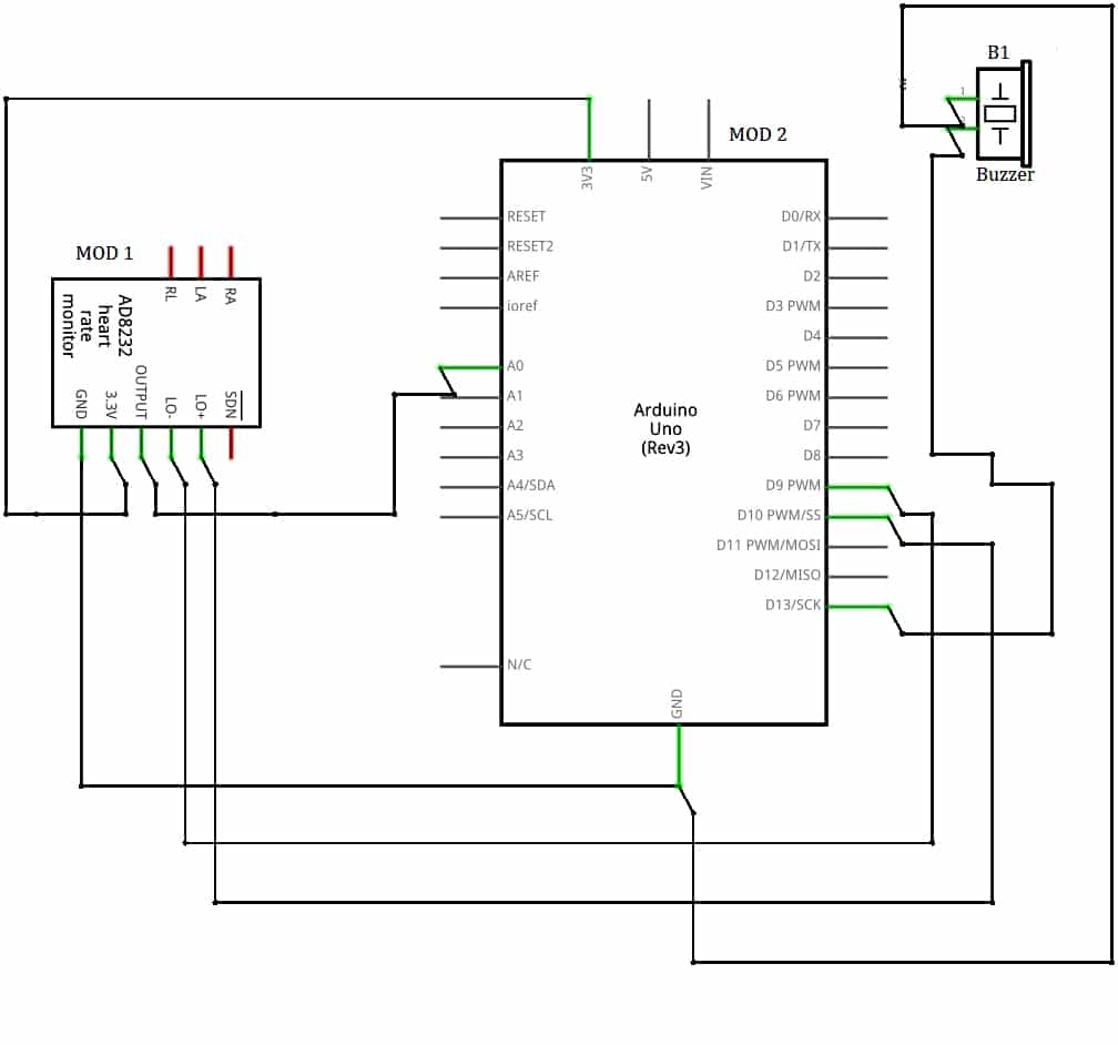 Sensor AD8232 and its interfacing with Arduino UNO