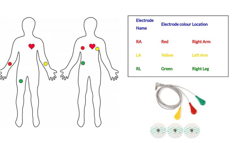 Lead positions on the human body, its color code and electrode connectors
