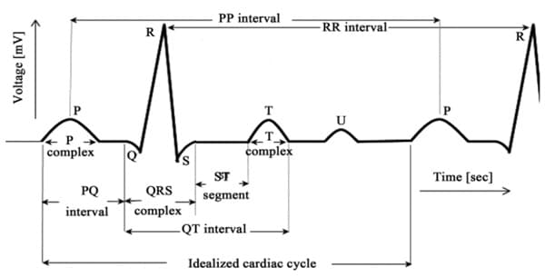 Figure 5: A typical healthy ECG to understand the PQRSTU cardiac cycle