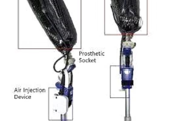 AI-Based Prosthetic Socket Developed To Help Thigh Amputees
