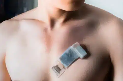 A wearable ultrasonic-system-on-patch mounted on the chest for measuring cardiac activity. Credit: Muyang Lin