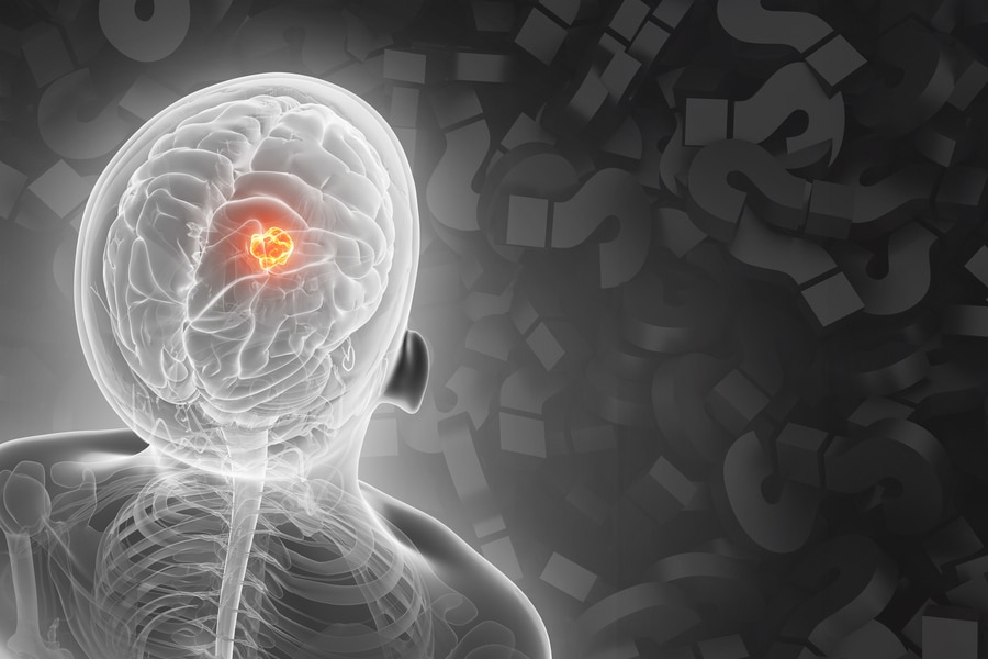 AI Model Aids In Determining The Origin Of A Patient’s Cancer