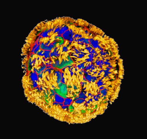 Human tracheal skin cells self-assemble into multi-cellular, moving organoids called Anthrobots. These images show Anthrobots with cilia on their surface (yellow) distributed in different patterns. Surface patterns of cilia are correlated with different movement patterns: circular, wiggling, long curves or straight lines. Credit: Gizem Gumuskaya, Tufts University
