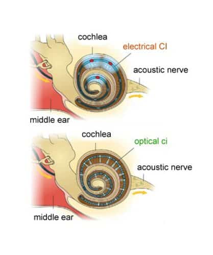 OLED-on-CMOS Probes For Future Cochlear Implants - Electronics For You