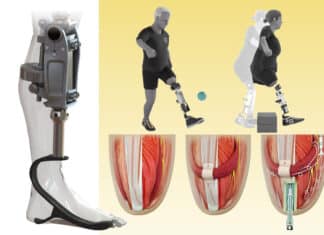 Bionic Knee In Tissue Restores Movement