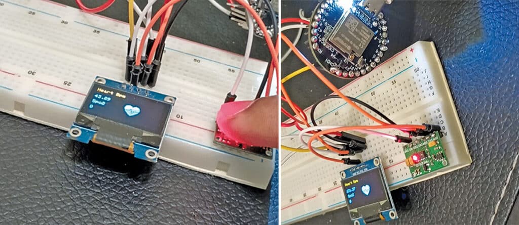 AI Health Monitoring System