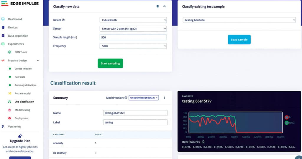 Training ML Model for Health Monitoring