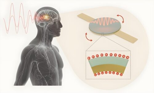 A tiny, injectable magnetoelectric antenna implanted deep in the brain can receive power from low-frequency external magnetic fields. “Our technology has the potential to introduce a new avenue for minimally invasive bioelectric devices that can operate wirelessly deep within the human body,” says MIT Associate Professor Deblina Sarkar.
Credits:Image: Baju Joy