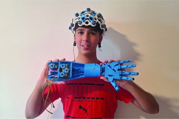 Teen Builds Working Thoughts-Managed Prosthetic In His Storage