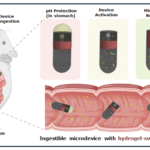 Tiny Device With Big Gut Answers