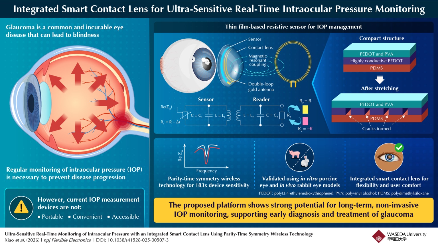 Contact Lenses Monitoring Glaucoma In Real Time