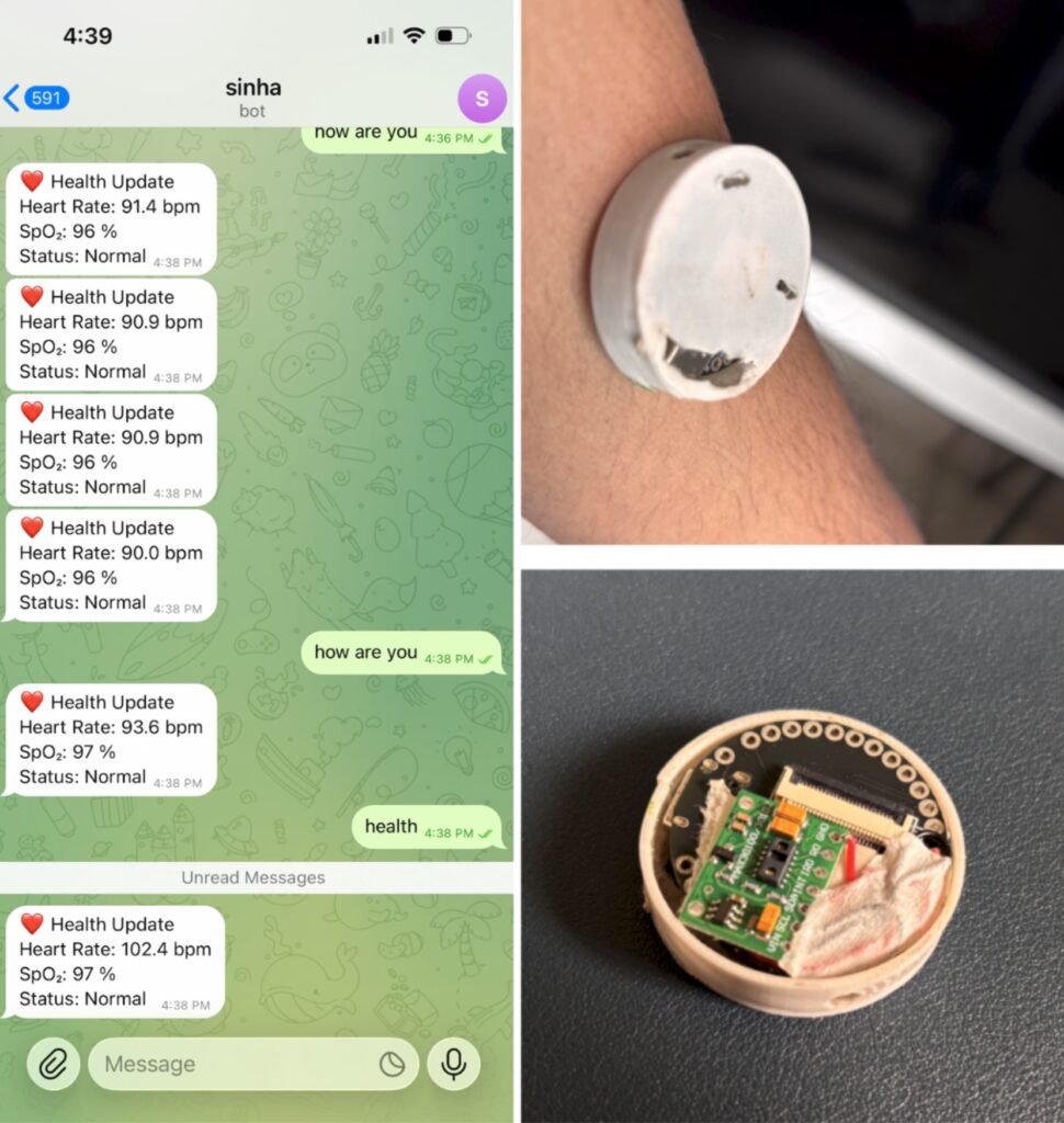Telegram-Based Wearable Health Monitoring System