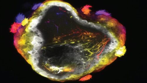 Neurobots have a surface of specialized cells and a nervous system controlling motion.