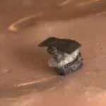 Seed-Sized Robot Advances Surgery