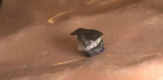 Seed-Sized Robot Advances Surgery