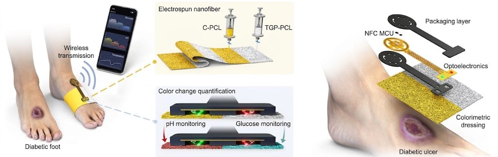 Conceptual Diagram of a Multimodal Colorimetric Dressing and Optoelectronic Sensor for Diagnosing Diabetic Foot and Diabetic Diseases