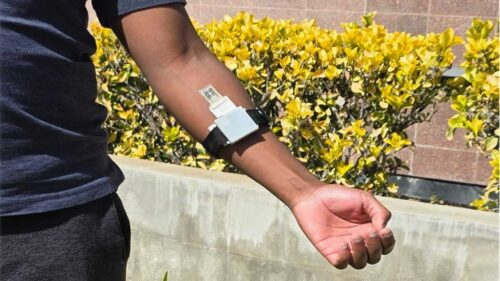 Wearable skin patch tracks cortisol, glucose, lactate and urea in sweat using a smartphone or wrist-worn reader.