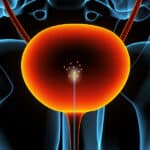 Nanotube Catheter Sensor Advances Detection