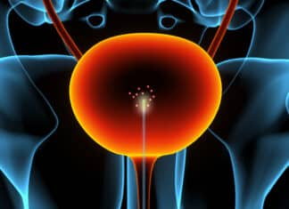 Nanotube Catheter Sensor Advances Detection