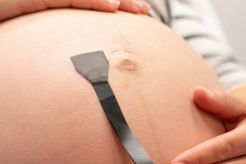 Researchers have developed a wearable patch to monitor high-risk pregnancies. It connects to a computer that interprets ultrasound data. | Sheng Xu