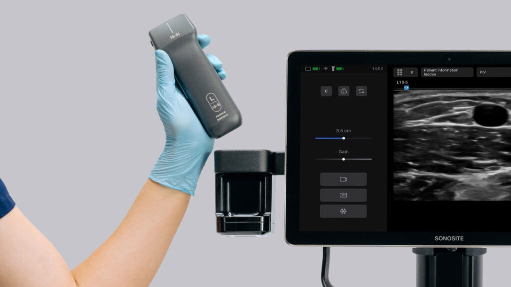 FUJIFILM Sonosite Expands Portfolio with the Launch of Sonosite iLOOK, a Dedicated Ultrasound Solution for Vascular Access