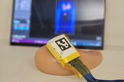 An experimental validation setup shows the 3D ultrasound probe positioned on a tissue-mimicking breast phantom for the visualization of an embedded tumor model.
Credit: Courtesy of the researchers